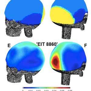 Personalised electrical brain imaging (PEBI)