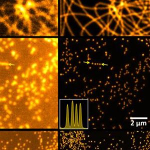 Super-resolution confocal microscopy enhanced by deep-learning (SCORED)