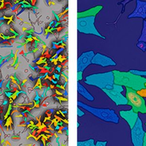 ATTRACT: funding innovation in imaging. EMBL researchers and collaborators secure funding for four projects