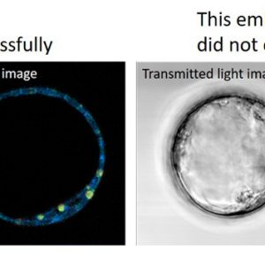 ATTRACT featured stories: Metabolic profiling of in vitro fertilisation embryos using hyspectral imaging (HYSPLANT)
