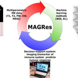 ATTRACT featured stories: Multiparametric MR approaches for non-invasive glioblastoma therapy response follow-up (MAGRes)