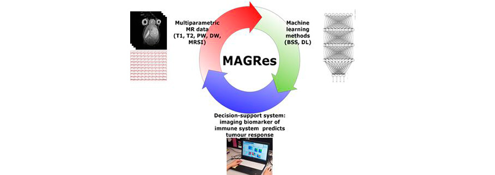 ATTRACT featured stories: Multiparametric MR approaches for non-invasive glioblastoma therapy response follow-up (MAGRes)