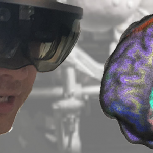 ATTRACT featured stories:  Mixed reality for brain functional and structural navigation during neurosurgery (MRbrainS)